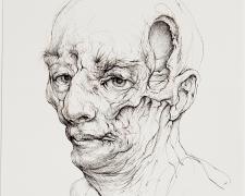 Syphilitic Skull Reconstructed, 2018, ink on paper, p.s. 9 7/8 x 6" / f.s. 17 1/2 x 13 1/2"